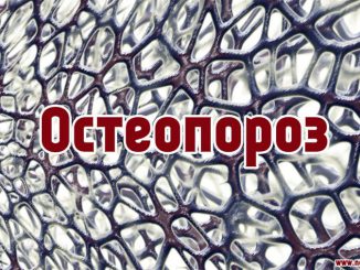 Остеопороз: всё про симптомы, причины и лечение