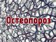 Остеопороз: всё про симптомы, причины и лечение