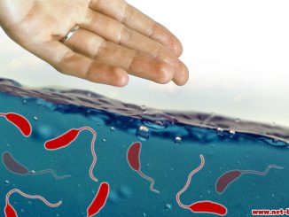 Что такое холера: Причины, симптомы, профилактика и лечение инфекции